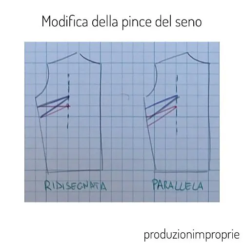 Immagine esplicativa di due tecniche per modificare in altezza la pince del seno
